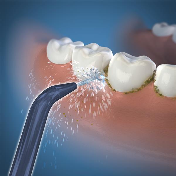 Precision Low Flow Jet Tip JT-360E | Replacement Tips - Image 3