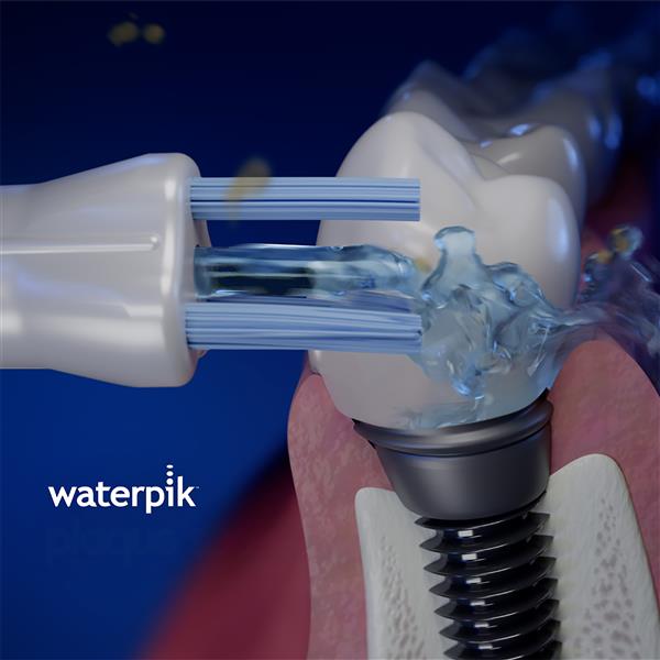 Whitening Plaque Seeker™ Tip WPS-2E | Replacement Tips - Image 3